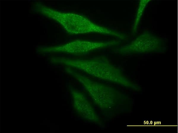 IHC-plus™ AKR1C4 / Chlordecone Reductase Antibody (clone 2C11)