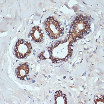 KRT18 / CK18 / Cytokeratin 18 Antibody