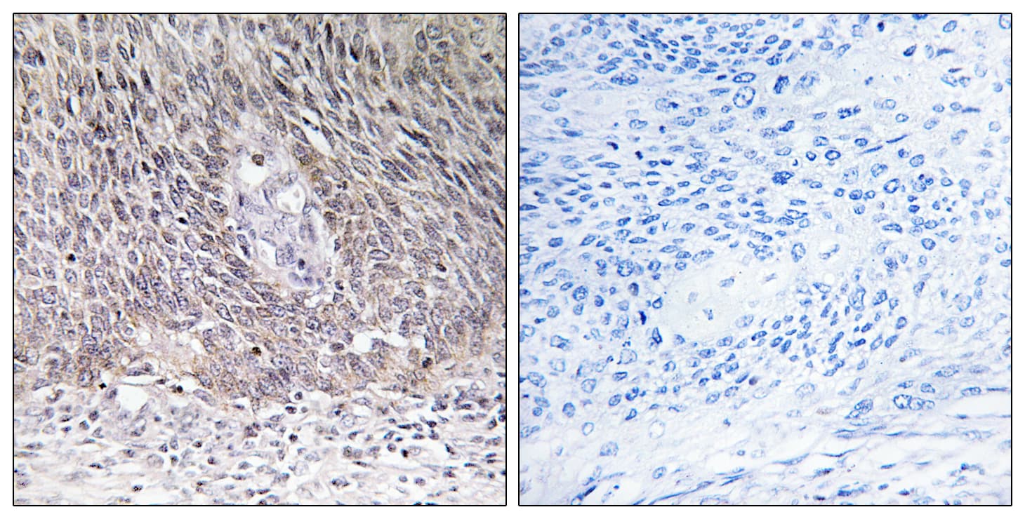 Polyclonal Rabbit anti-Human ARSA / Arylsulfatase A Antibody (aa251-300, IHC, WB)