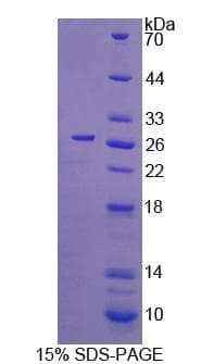 Human CDC42 Protein (Recombinant His-T7)