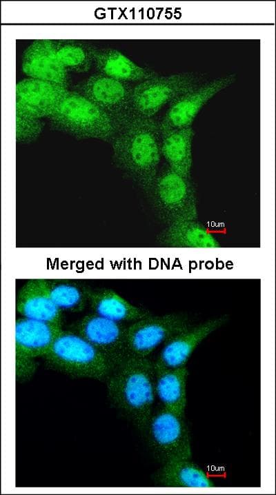Polyclonal Rabbit anti-Human FBXL3 Antibody (aa14-309, WB)