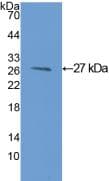 Rat GSTM1 Protein (Recombinant His, N-Terminal)