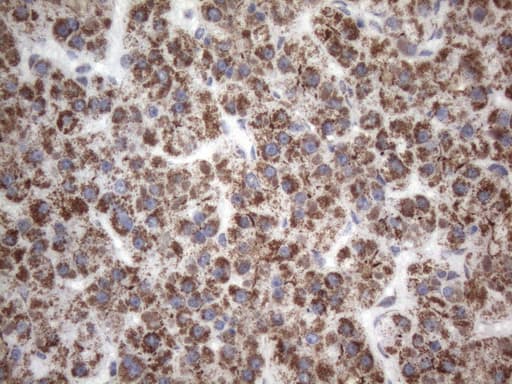 Monoclonal Mouse anti-Human SDHB Antibody (clone OTI2A1, Carrier-free, IHC, WB)