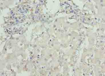 Polyclonal Rabbit anti-Human DCX / Doublecortin Antibody (IHC)