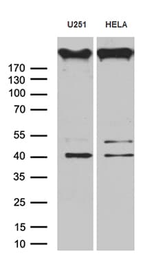 Gravin / AKAP12 Antibody (aa266-557, clone OTI1B6, Carrier-free)