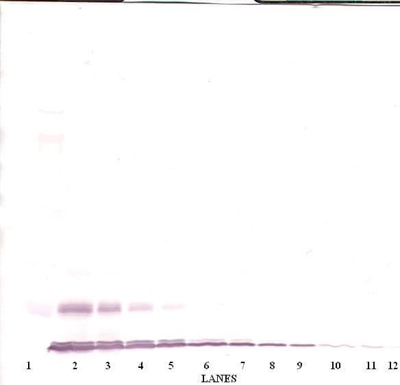 CCL2 / MCP1 Antibody