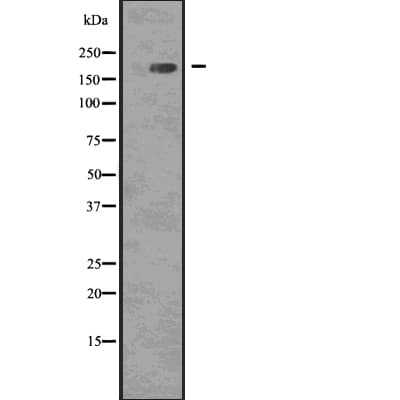 EGFR Antibody (phospho-Tyr1068)