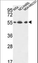 ATP5A1 / ATP Synthase Alpha Antibody (aa477-503)