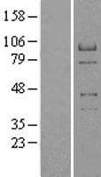 Human RACGAP1 / MGCRACGAP Protein (Over-Expression Lysate Myc-DDK (Flag))