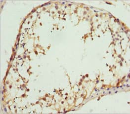 RACGAP1 / MGCRACGAP Antibody