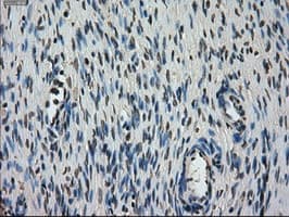 STK39 / SPAK Antibody (clone OTI3C12)