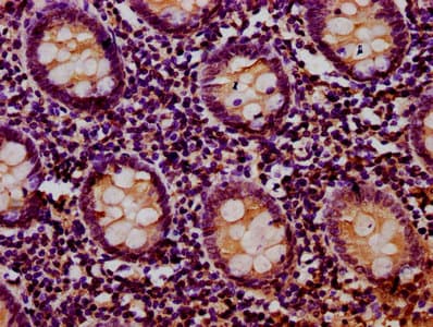 RIOK2 Antibody