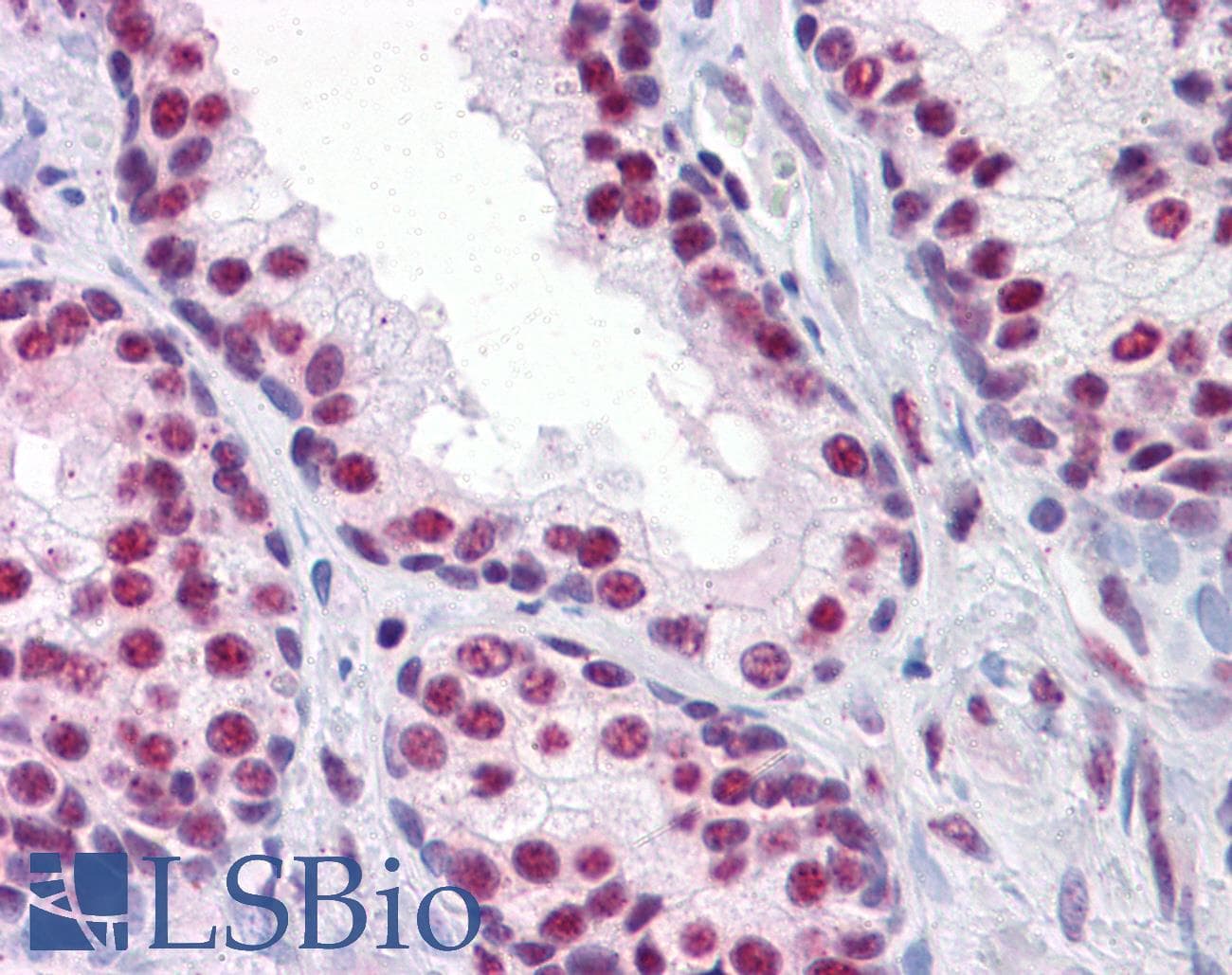 PathPlus™ CBFA1 / RUNX2 Antibody (clone 4D5)