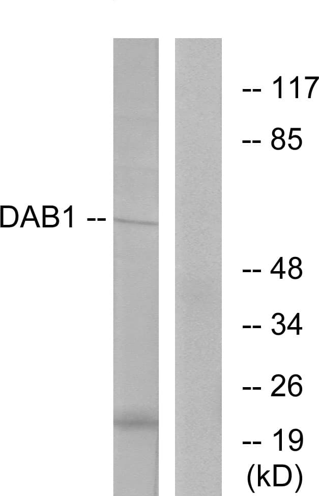 IHC-plus™ DAB1 Antibody (aa187-236)