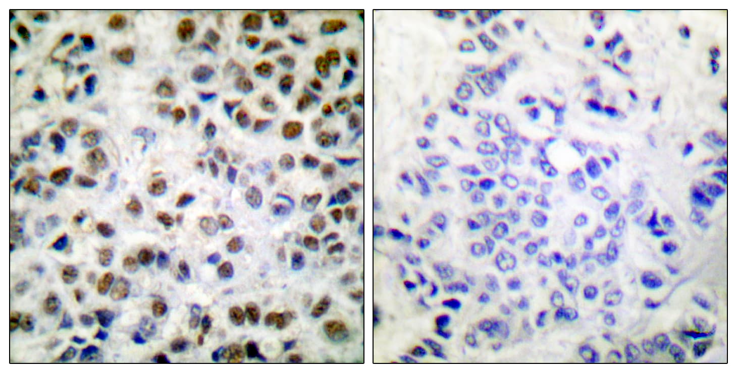 POLR2A / RNA polymerase II Antibody (phospho-Ser1619)