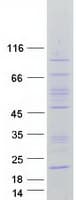 Human FAM86C1 Protein (Recombinant Myc-DDK (Flag))