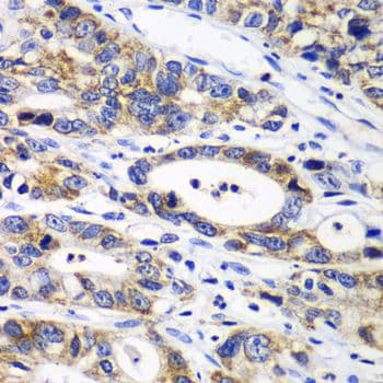 RPN1 / Ribophorin I Antibody