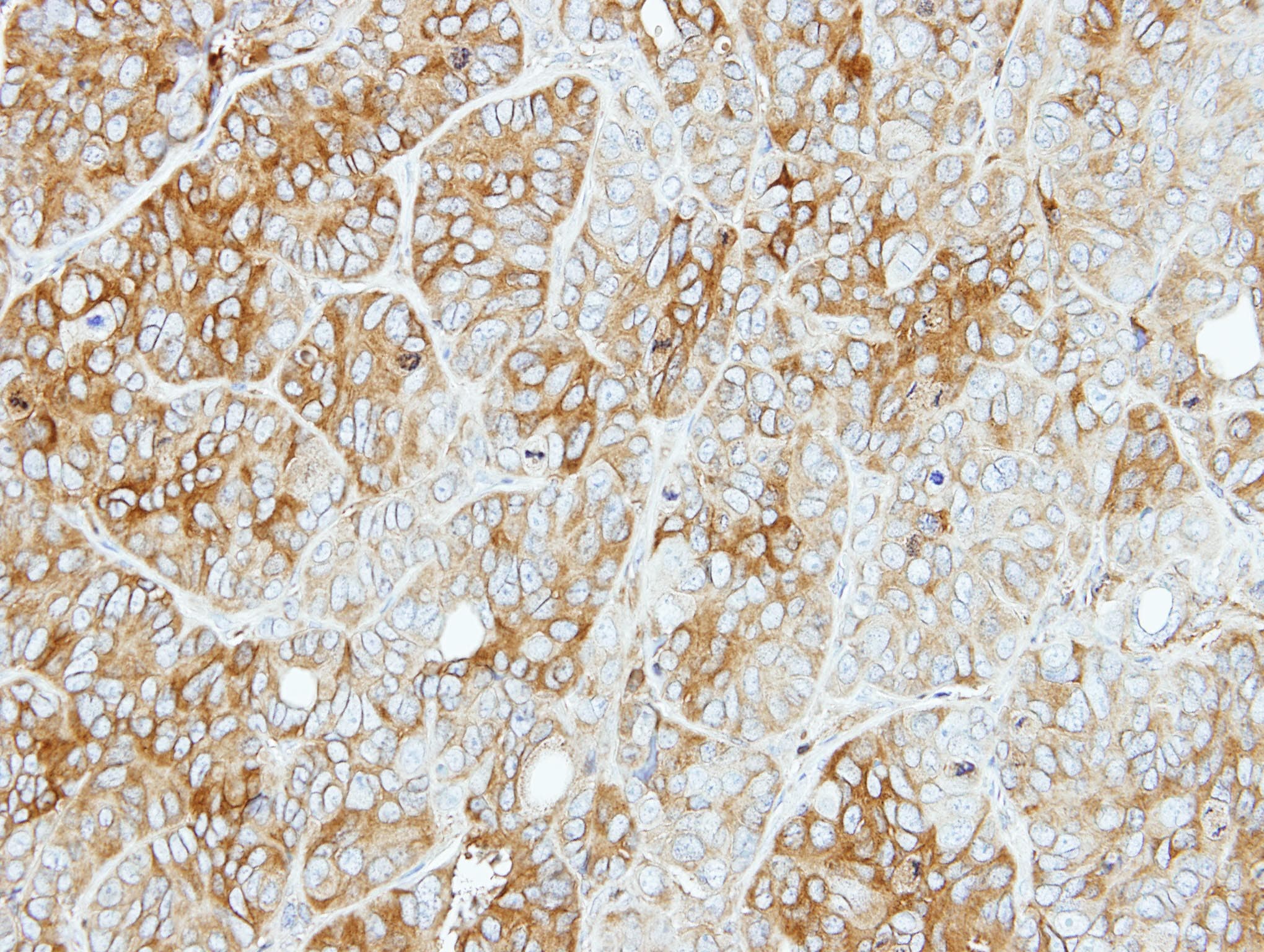 PFKL Antibody (aa428-674)