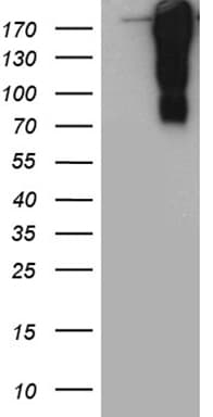 TP53BP1 / 53BP1 Antibody (aa1-300, clone OTI5H4)