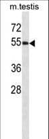 WWOX Antibody (aa369-396)