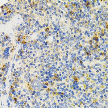Polyclonal Rabbit anti-Human SH2B1 Antibody (IHC, IF, WB)
