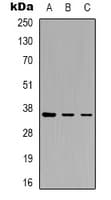 YBX1 / YB1 Antibody (phospho-Ser102)
