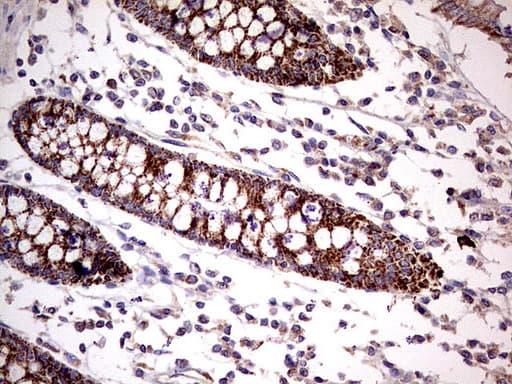 Monoclonal Mouse anti-Human PDSS2 / DLP1 Antibody (clone UMAB177, IHC, WB)