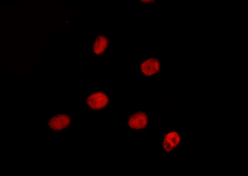 PRPF38A Antibody