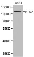 Polyclonal Rabbit anti-Human FAK / Focal Adhesion Kinase Antibody (IHC, WB)