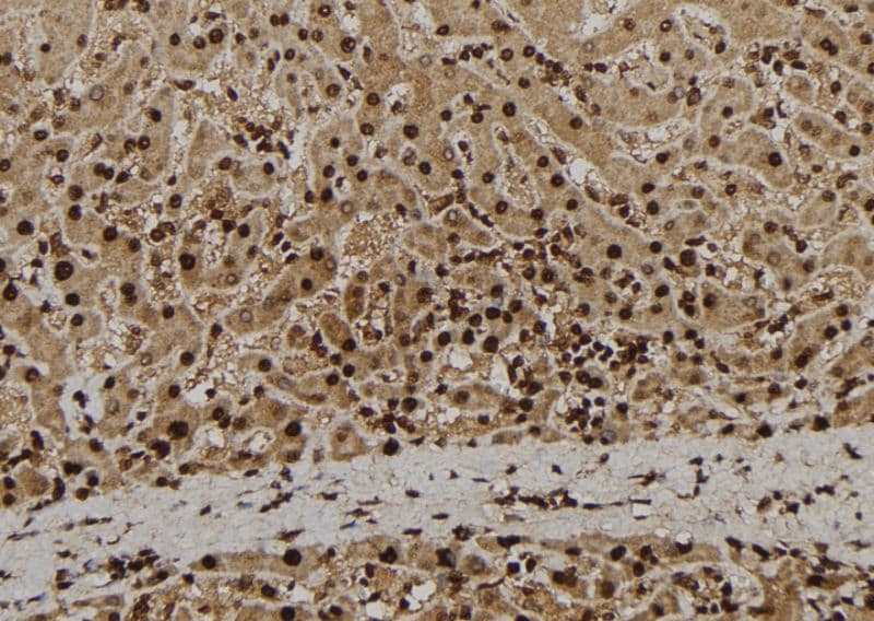 ADAM33 Antibody