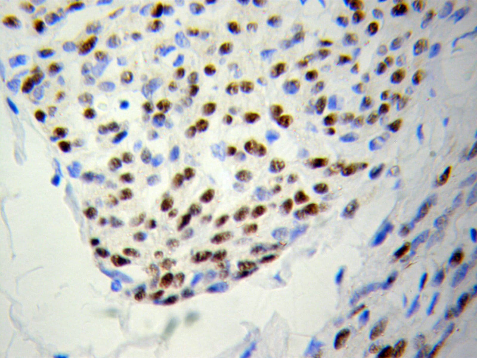 PSME3 Antibody