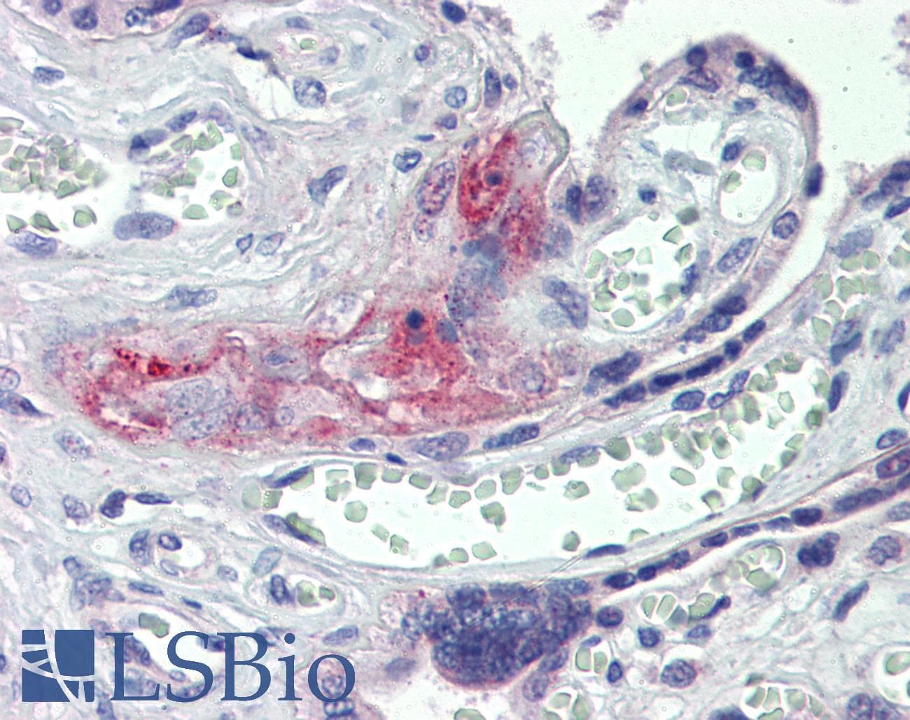 IHC-plus™ F2 / Prothrombin / Thrombin Antibody (aa396-445)