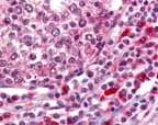 OGG1 Antibody (aa1-100, DY488)