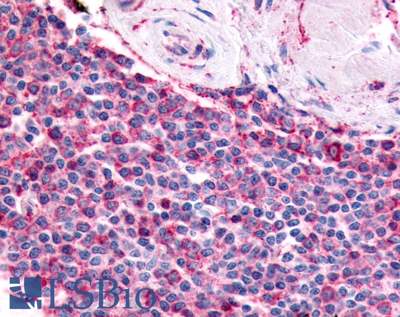 PathPlus™ Polyclonal Rabbit anti-Human PGES / PTGES Antibody (Cytoplasmic Domain, IHC)