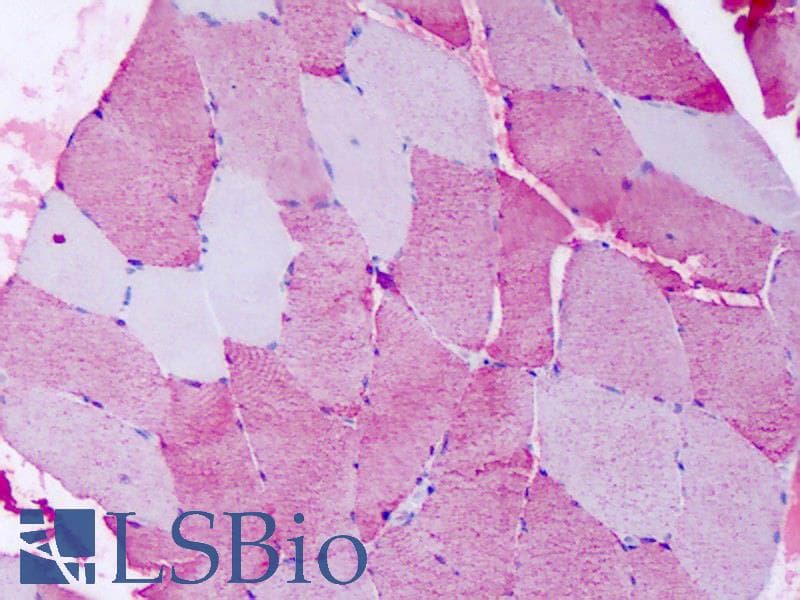 IHC-plus™ FZD6 / Frizzled 6 Antibody (N-Terminus)