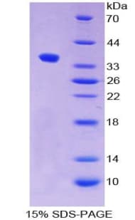 Human ALPPL2 Protein (Recombinant His)