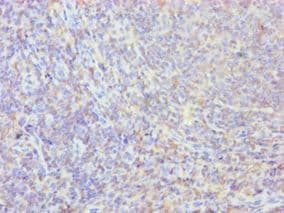Polyclonal Rabbit anti-Human PPIB / Cyclophilin B Antibody (aa34-216, IHC, WB)