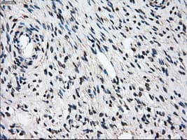 Monoclonal Mouse anti-Human PSMD10 / Gankyrin Antibody (clone OTI3F6, WB)