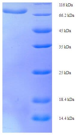Human D2HGDH Protein (Recombinant His-SUMO)