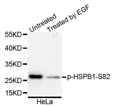 Polyclonal Rabbit anti-Human HSPB1 / HSP27 Antibody (phospho-Ser82, IHC, IF, WB)