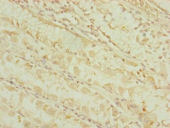 DHTKD1 Antibody