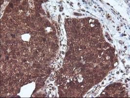DSTN / Destrin Antibody (clone OTI1G8, Carrier-free)
