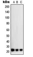 SOCS2 Antibody (Internal)