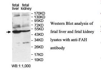 Polyclonal Rabbit anti-Human FAH Antibody (aa236-408, IHC, WB)