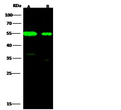 TUBB3 / Tubulin Beta 3 Antibody (Preservative Free)