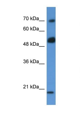 Polyclonal Rabbit anti-Human ARHGAP36 / FLJ30058 Antibody (aa81-130, WB)