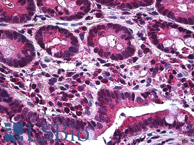 IHC-plus™ MCL1 / MCL 1 Antibody (aa121-139)