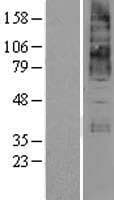 KCNN4 / KCa3.1 Protein (Over-Expression Lysate Myc-DDK (Flag))