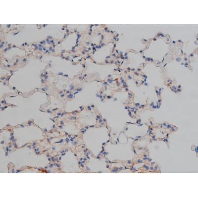 MAPT / Tau Antibody (phospho-Ser422)