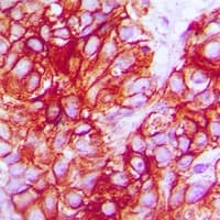 NTRK2 / TRKB Antibody (C-Terminus)